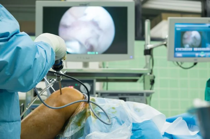 Arthroscopy Surgeries